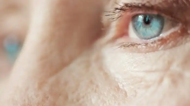 شكل العين بعد عملية المياه البيضاء