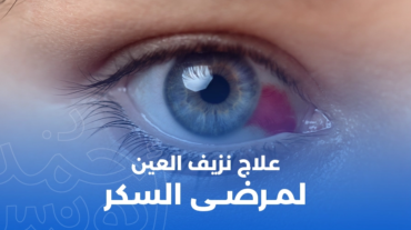 علاج نزيف العين لمرضى السكر