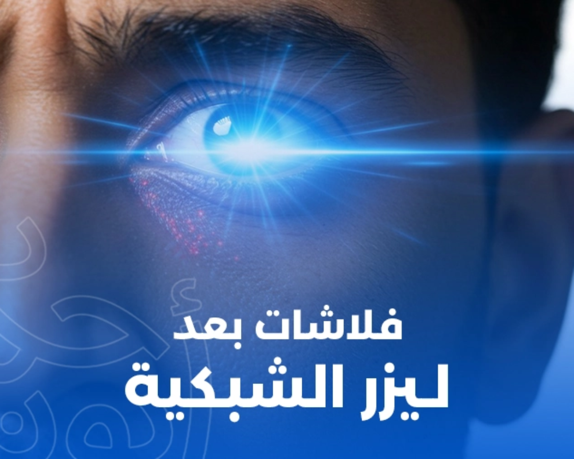 فلاشات بعد ليزر الشبكية