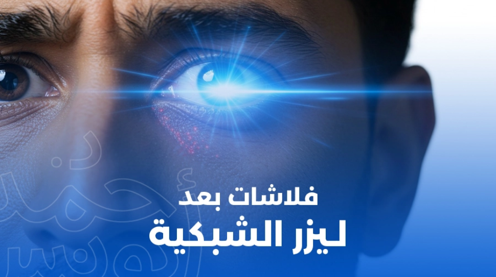 فلاشات بعد ليزر الشبكية