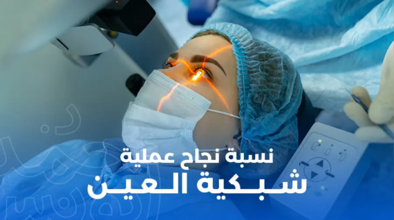 نسبة نجاح عملية انفصال شبكية العين