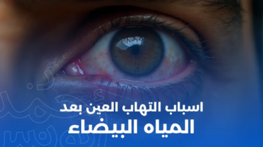 أسباب التهاب العين بعد عملية المياه البيضاء