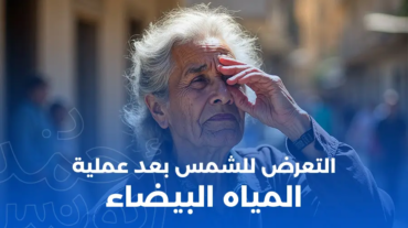 التعرض للشمس بعد عملية المياه البيضاء