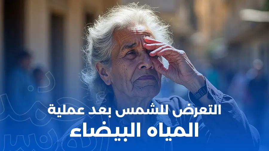 التعرض للشمس بعد عملية المياه البيضاء