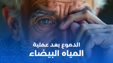 الدموع بعد عملية المياه البيضاء