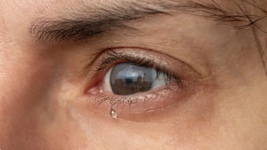 ما سبب نزول دموع بعد عملية المياه البيضاء