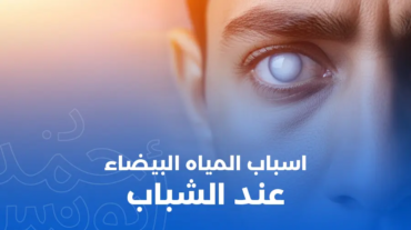 أسباب المياه البيضاء عند الشباب