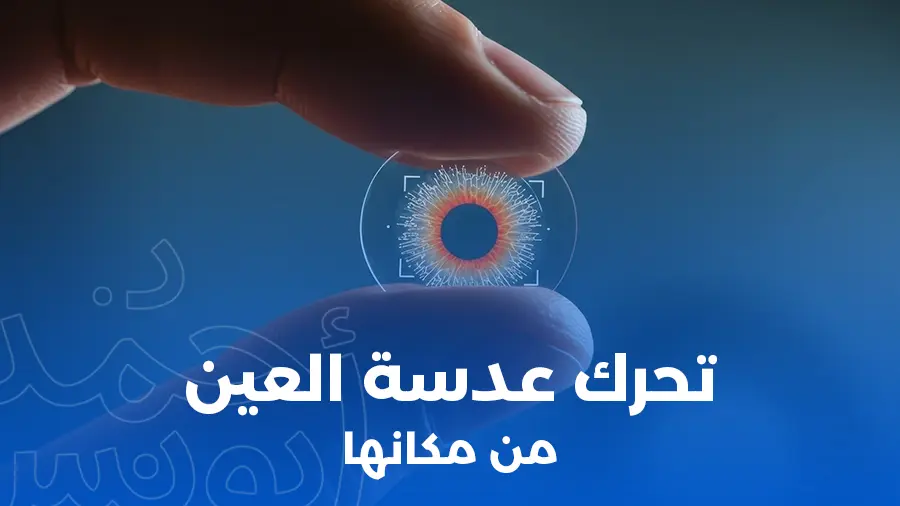 أعراض تحرك عدسة العين من مكانها بعد عملية المياه البيضاء