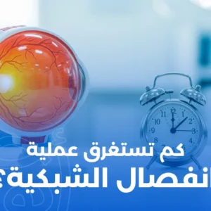 كم تستغرق عملية انفصال الشبكية؟