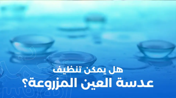 هل يمكن تنظيف عدسة العين المزروعة